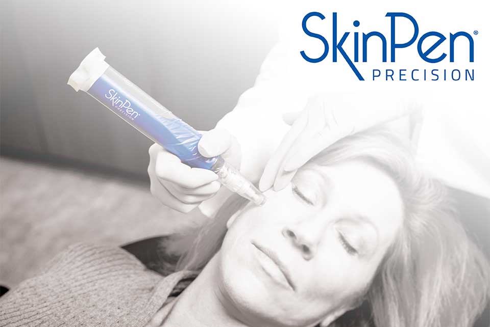 SkinPen - The Beauty Doctor Leicester